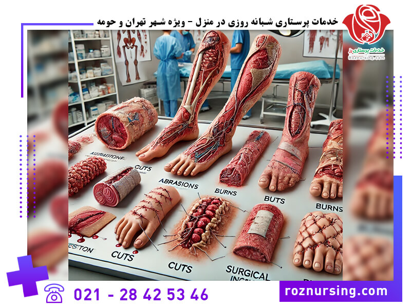 درمان زخم-201