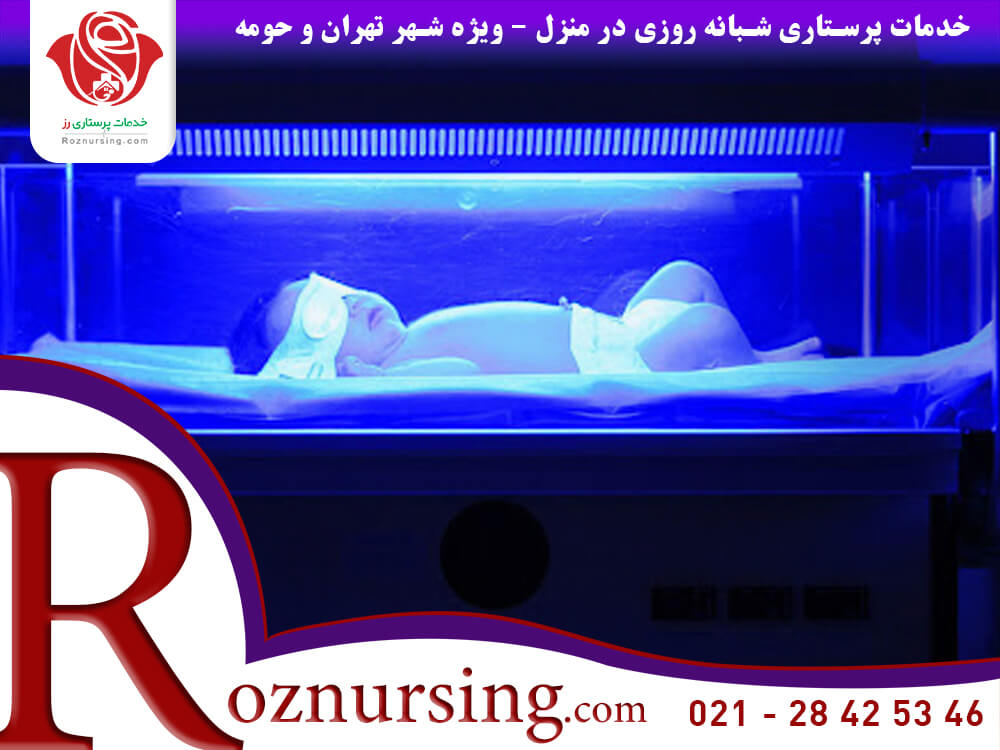 درمان زردی نوزاد-322