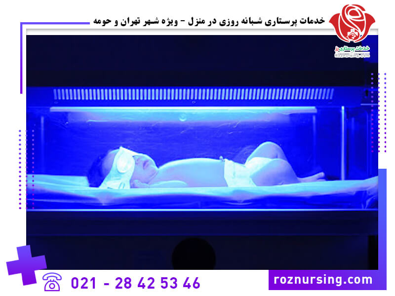 درمان زردی نوزاد-321