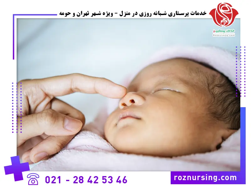 درمان زردی نوزاد در منزل-2342